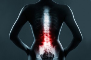 dolor-espalda-articulo